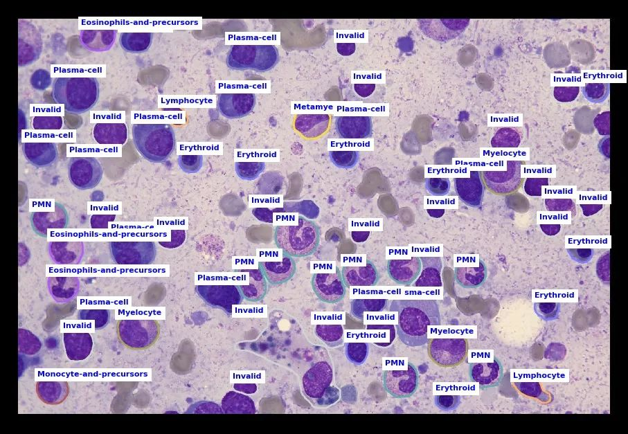 机器视觉在机器人行业的应用（下）